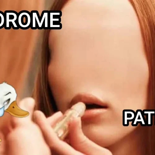 Síndrome do Patinho Feio