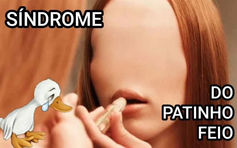 Síndrome do Patinho Feio